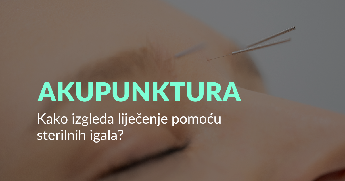 Akupunktura: liječenje i preventiva pomoću sterilnih igala